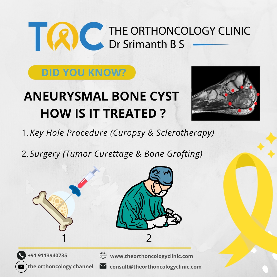 Aneurysmal Bone Cyst — How is it treated?
