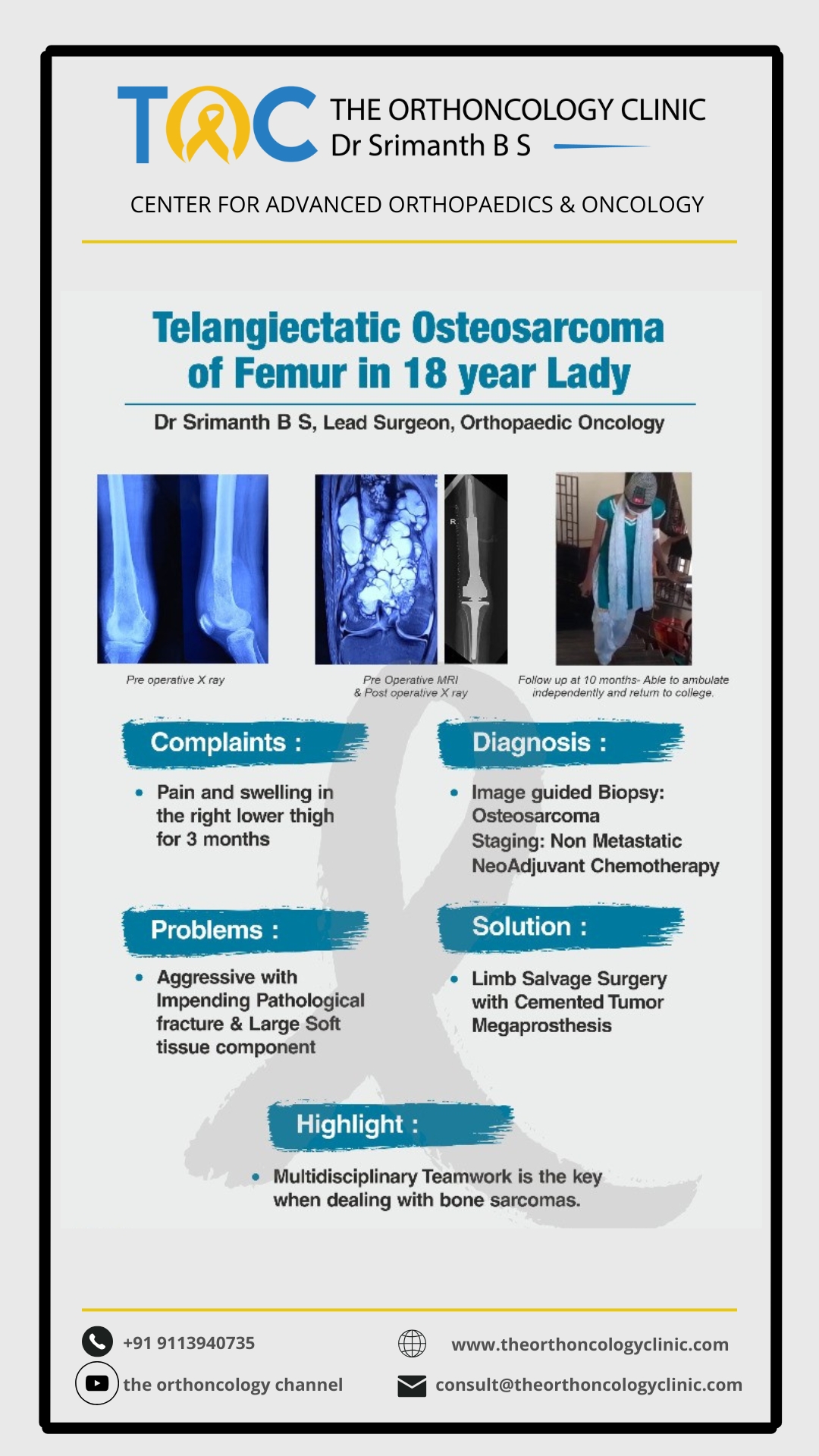 Telangiectatic osteosarcoma of femur in 18-year-old — pre-op X-ray, MRI, post-op X-ray and follow-up at 10 months