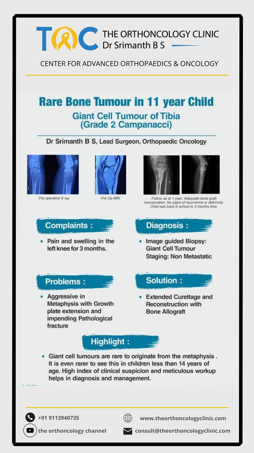 Rare GCT of Tibia in an 11-year-old