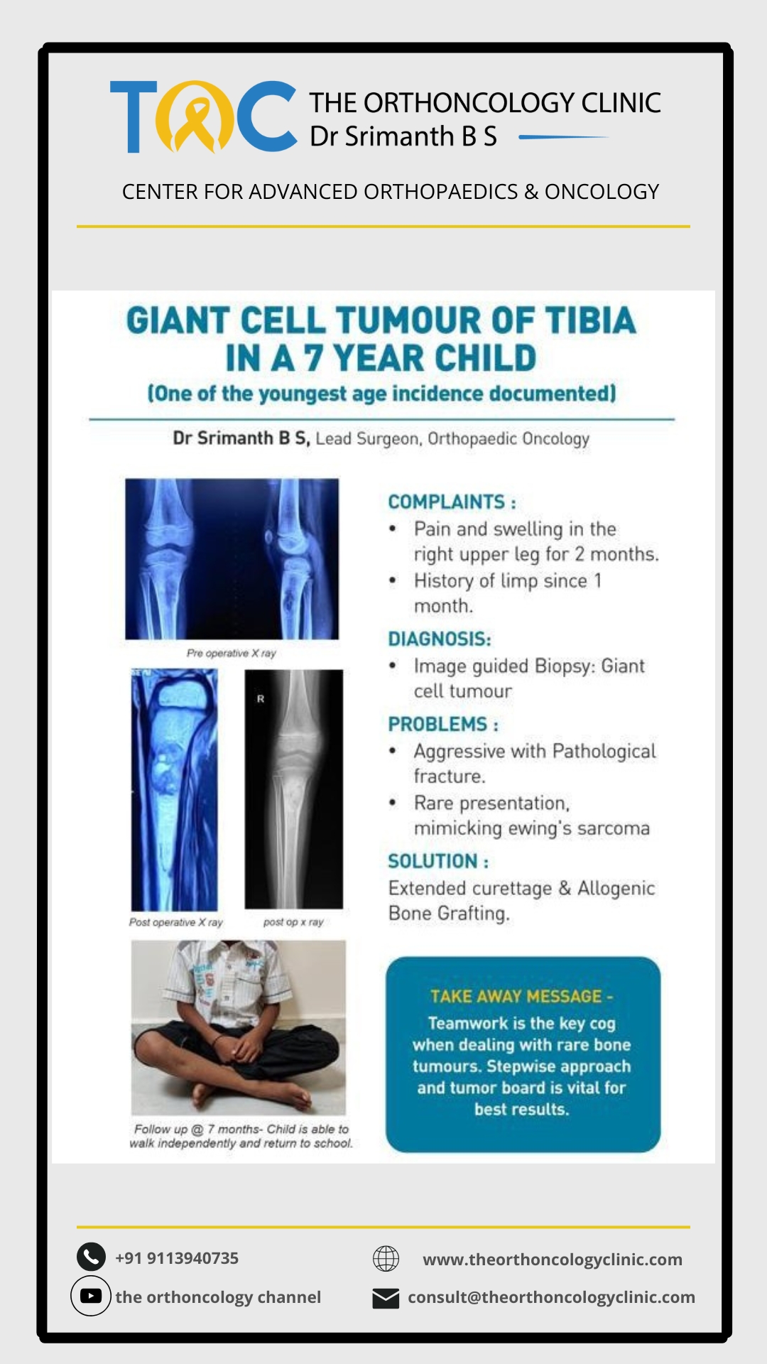 Giant Cell Tumour of Tibia in a 7-year-old