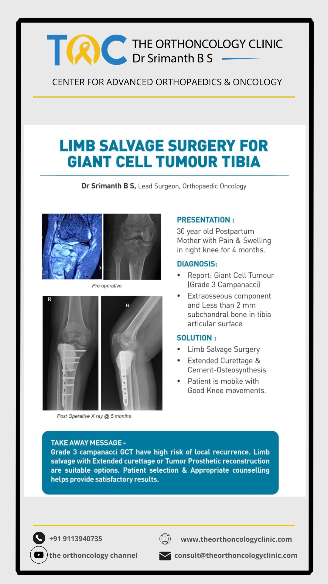 Limb Salvage for Giant Cell Tumour of Tibia