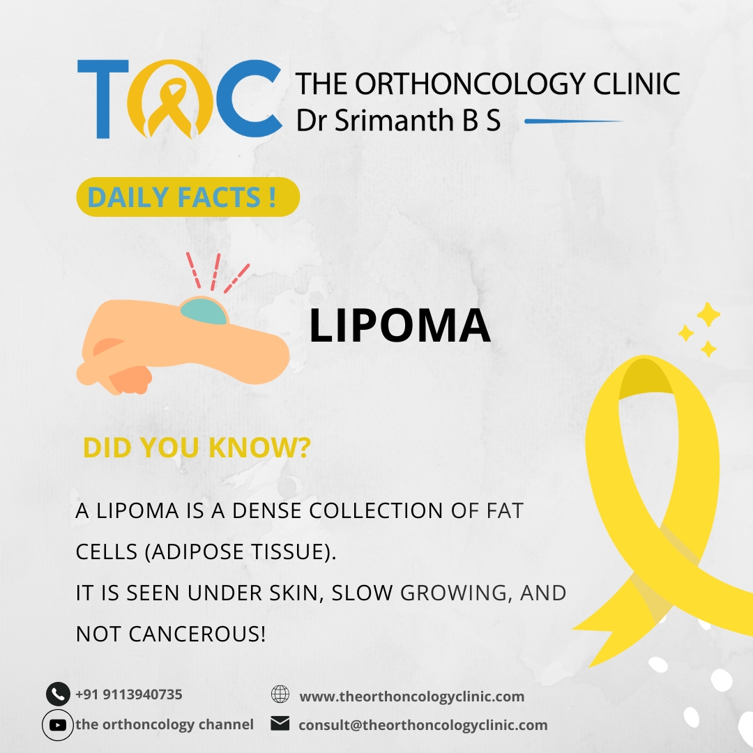 Lipoma — Daily Facts