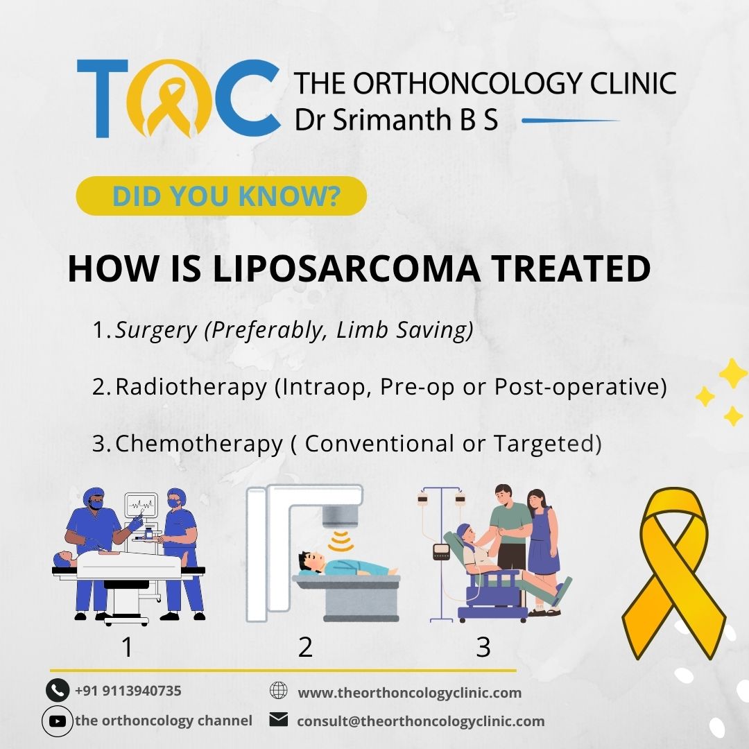 How is Liposarcoma Treated?